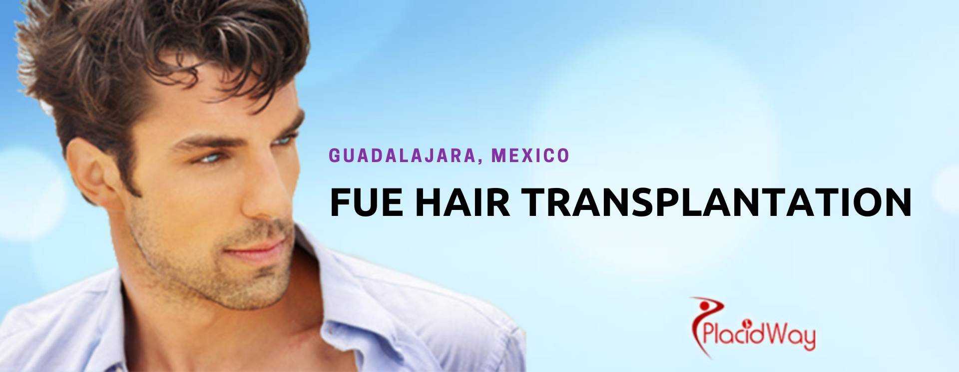 FUE Hair Transplants in Guadalajara Mexico